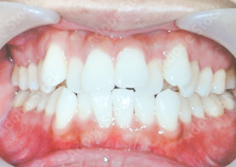 準備中です_before