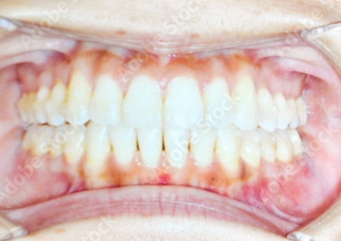 準備中です_after